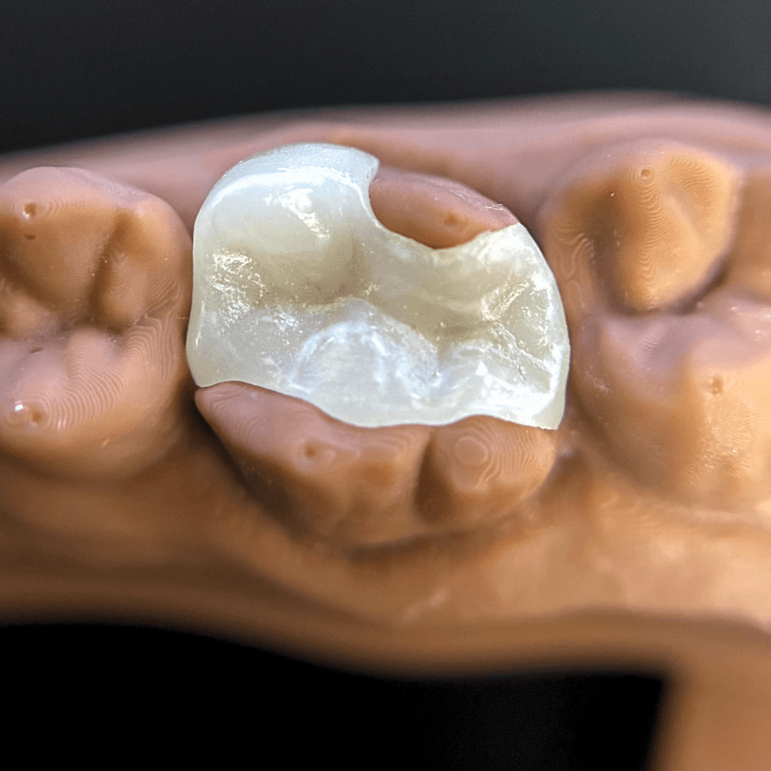 3D Printed Dental Prosthetics