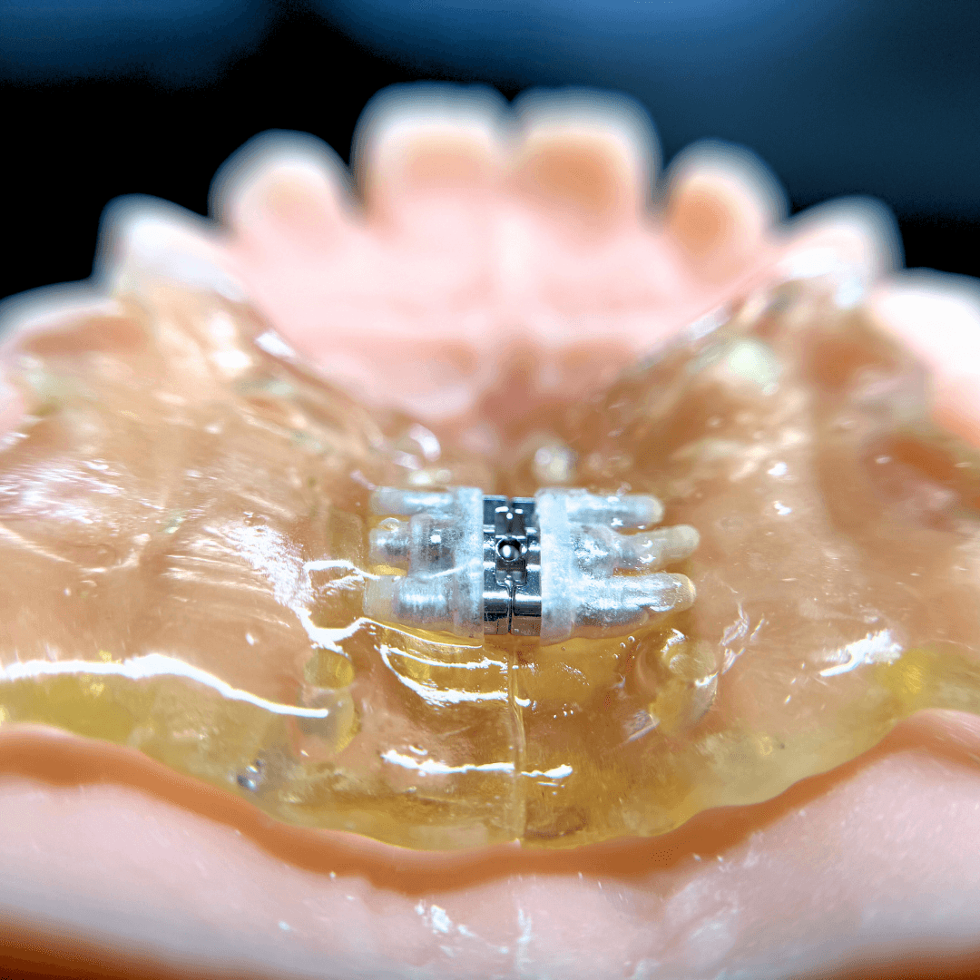 Digital Dental Workflow