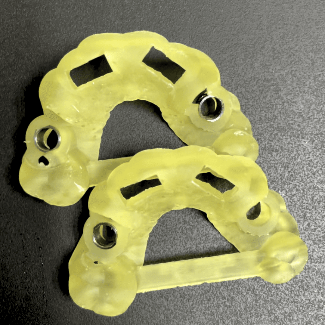 Guías Quirúrgicas para implantes o mini tornillos de ortodoncia
