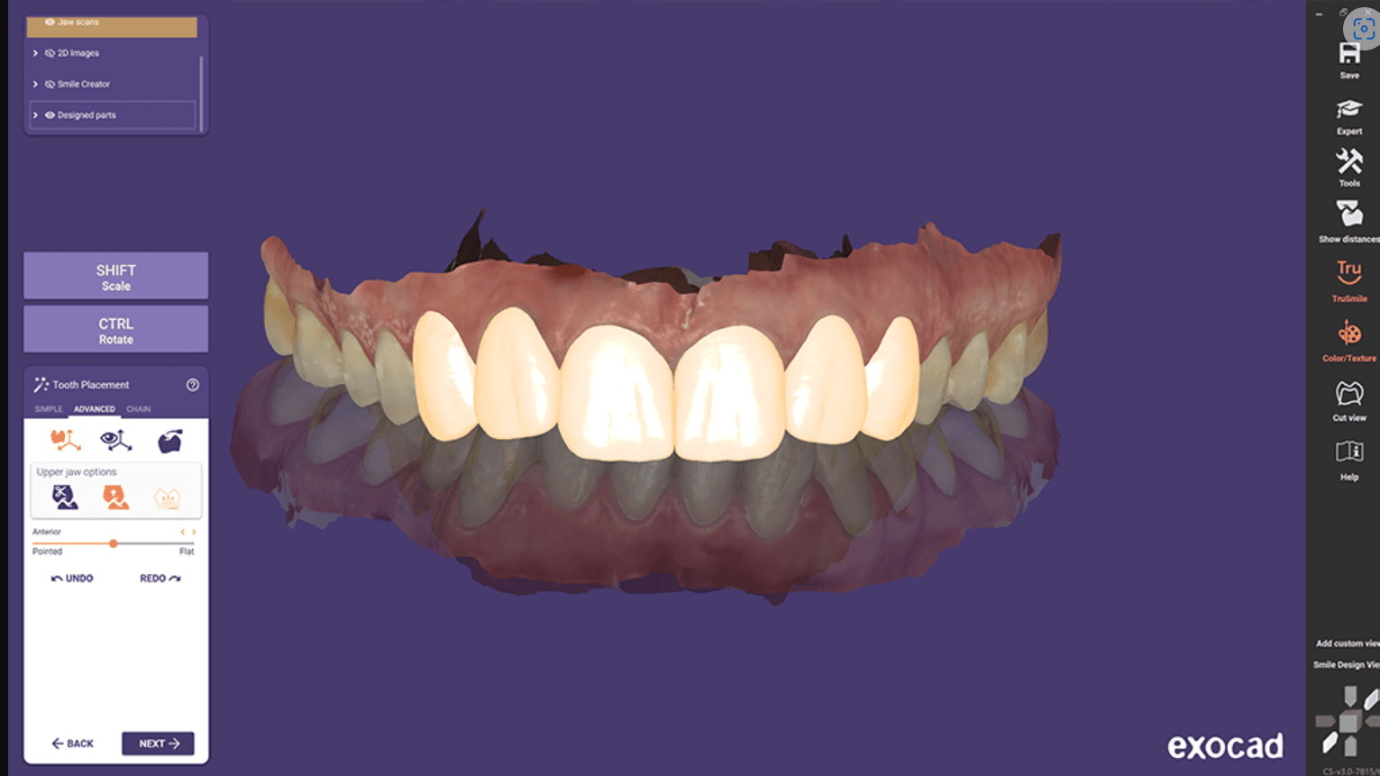 Diseños de sonrisa
