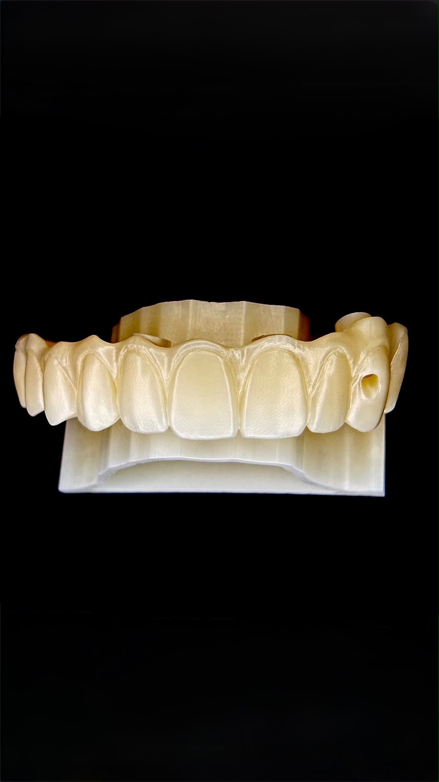 Arco completo sobre modelo impreso en 3D